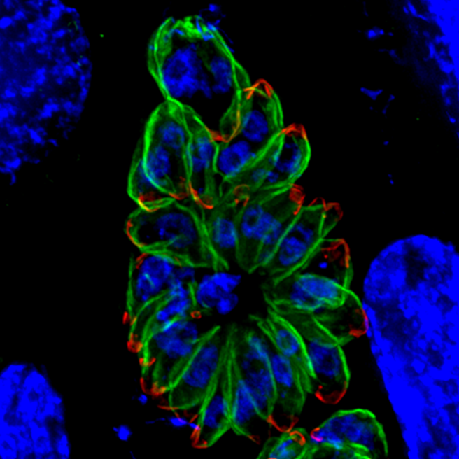 Toxoplasma_gondii_infection